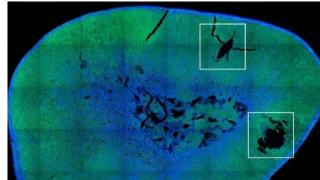 研究人员使用磁性纳米粒子实现激素释放的远程控制