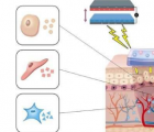 微型发电机可以加速伤口愈合