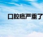 口腔癌严重了会死人吗（口腔癌死人吗）