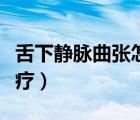 舌下静脉曲张怎么消除（舌下静脉曲张怎么治疗）