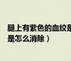 腿上有紫色的血纹是怎么回事凹下去了（腿上有紫色的血纹是怎么消除）