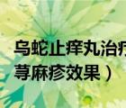 乌蛇止痒丸治疗荨麻疹效果（乌蛇止痒丸治疗荨麻疹效果）