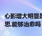 心影增大明显是什么意思（心影增大是什么意思,能够治愈吗）