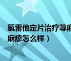 氯雷他定片治疗荨麻疹效果怎么样（开瑞坦氯雷他定片对荨麻疹怎么样）