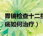 胃镜检查十二指肠溃疡如何治疗（十二指肠溃疡如何治疗）