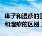 痱子和湿疹的区别新生儿长痱子怎么办（痱子和湿疹的区别）