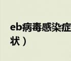 eb病毒感染症状及临床表现（EB病毒感染症状）