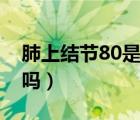 肺上结节80是肺癌吗（肺上结节80%是肺癌吗）