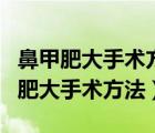 鼻甲肥大手术方法有微波消融还有视频（鼻甲肥大手术方法）