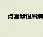 点滴型银屑病消退特点（点滴型银屑病）