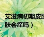 艾滋病初期皮肤痒会持续多久（艾滋病初期皮肤会痒吗）