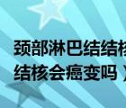 颈部淋巴结结核会癌变吗严重吗（颈部淋巴结结核会癌变吗）