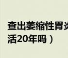 查出萎缩性胃炎医生却说没事（萎缩性胃炎能活20年吗）