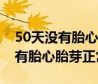 50天没有胎心胎芽还有希望吗（怀孕50天没有胎心胎芽正常吗）