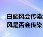 白癜风会传染给别人吗（白癜风传染吗 白癜风是否会传染）