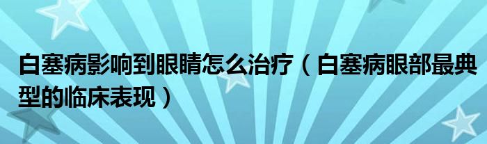 白塞病影响到眼睛怎么治疗（白塞病眼部最典型的临床表现）