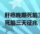 肝癌晚期死前三天症状 m.由来.cn（肝癌晚期死前三天征兆）