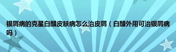 银屑病的克星白醋皮肤病怎么治皮屑（白醋外用可治银屑病吗）