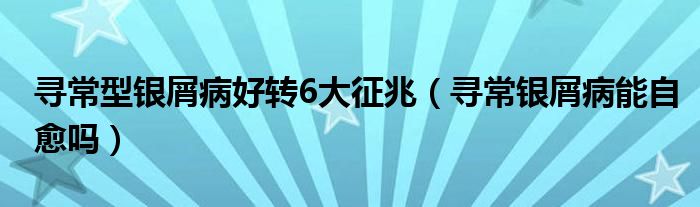 寻常型银屑病好转6大征兆（寻常银屑病能自愈吗）