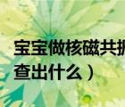 宝宝做核磁共振能检查出什么（核磁共振能检查出什么）