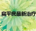 扁平疣最新治疗方法（扁平疣最佳治疗方法）